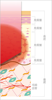 通常の光トリートメント